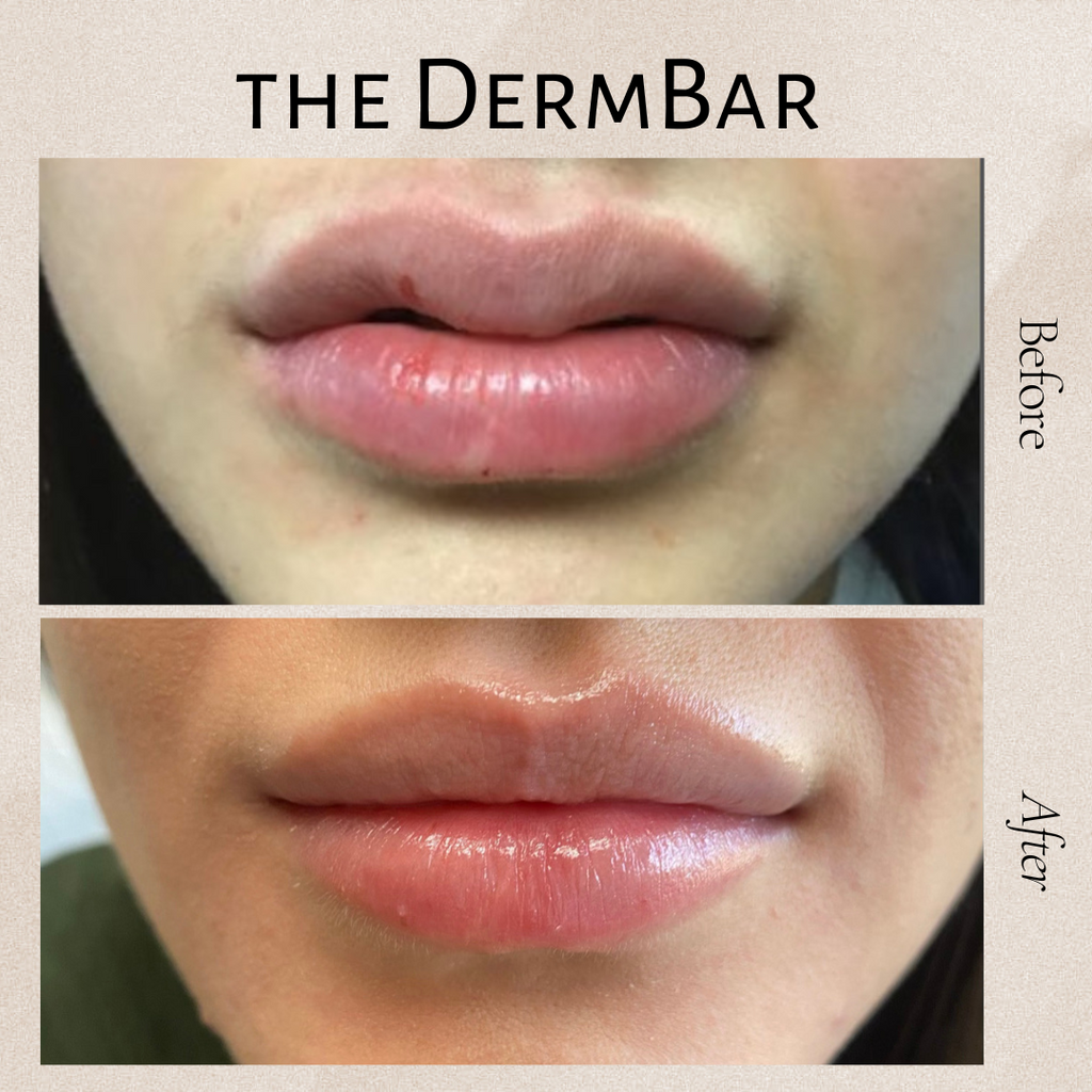 The DermBar